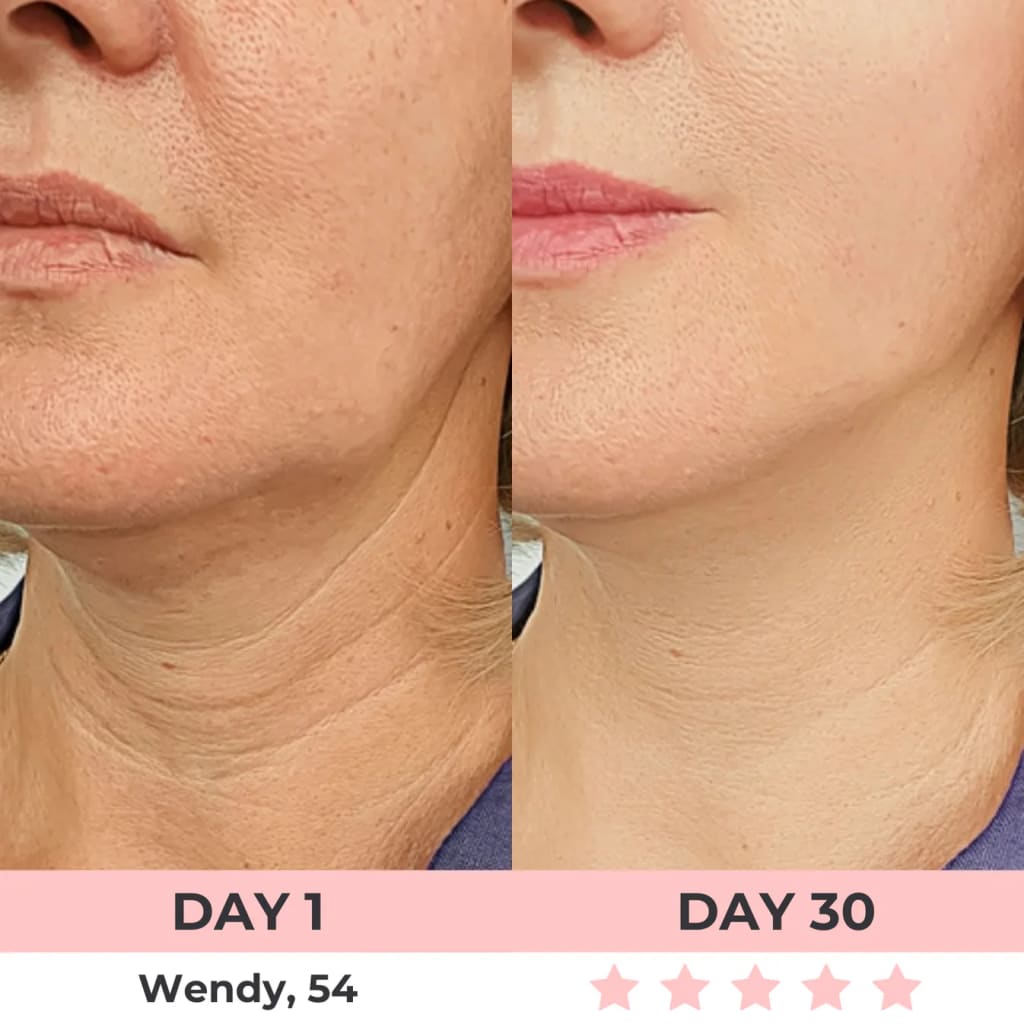 Radiant Lift