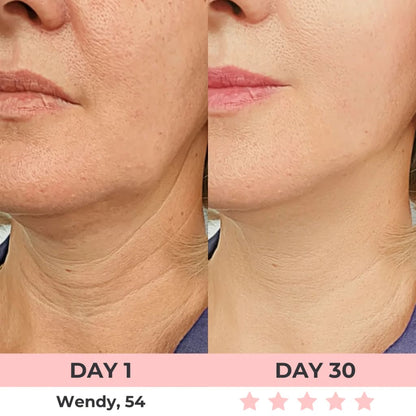 Radiant Lift